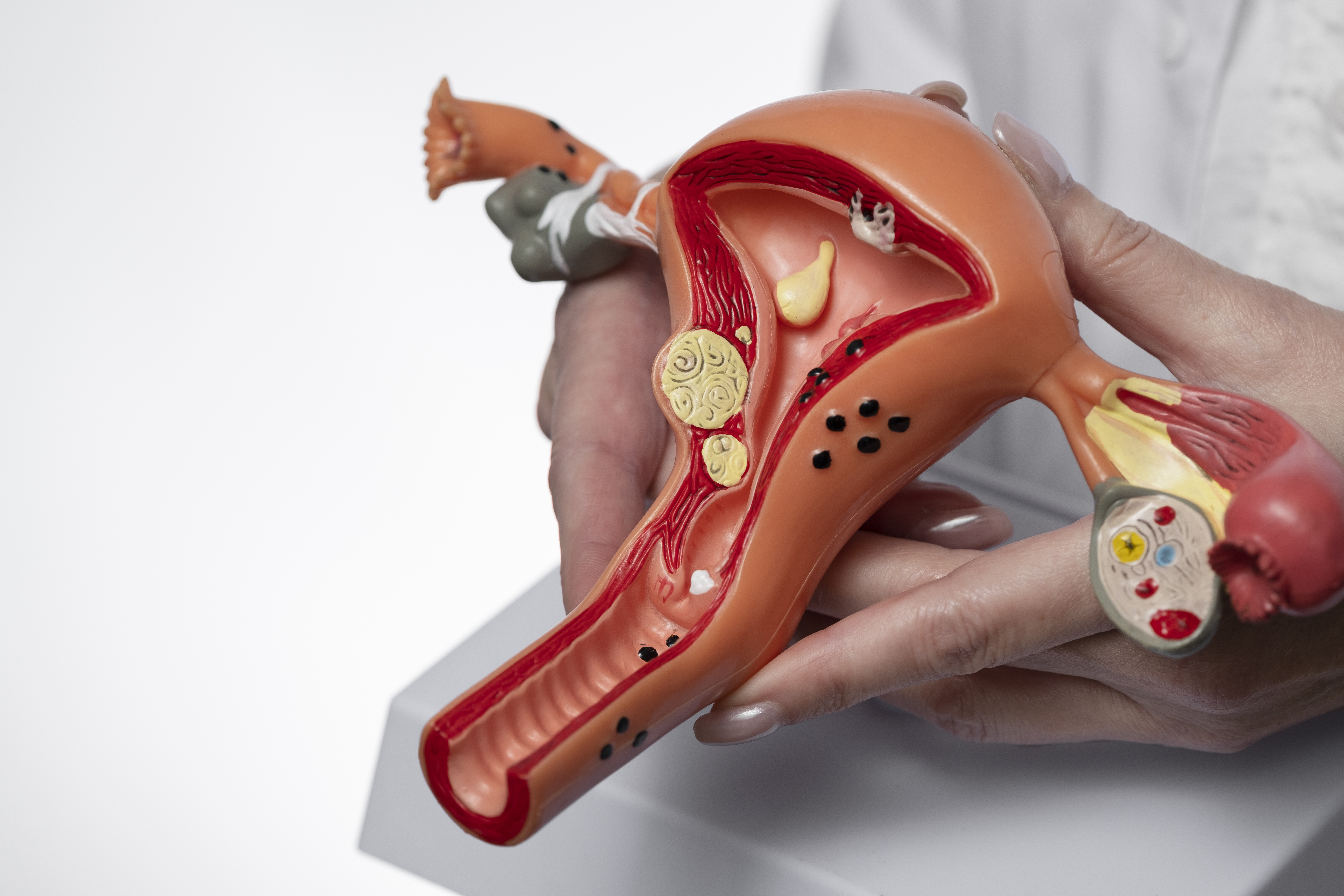 Colposcopy Procedure