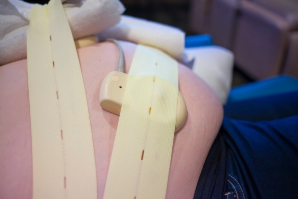 Fetal Monitoring